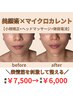 【オススメ★小顔効果アップ】小顔矯正＋マイクロカレント¥7500→