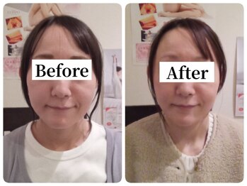 マンマ ジュンナ/【浜松/小顔/小顔矯正】