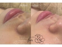 フルール(fleur)/bf→af