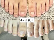 グラシナ 名古屋金山店/(深爪／長さだし/フィルイン)