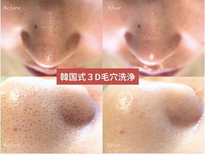 リセットプラス(Reset+)の写真