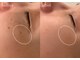 アールエーサロン 恵比寿 広尾(Ra salon)の写真