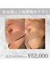 【年末前に☆】1ヶ月短期集中！肌質改善ピーリング4回　1回あたり￥13,000！