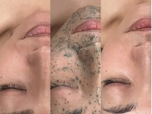 エステ ラミ(Esthe' l'ami)/REVIハーブピーリング