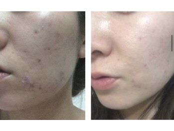 ディサイドロー(DECIDE L.A.W)/BeforeAfter