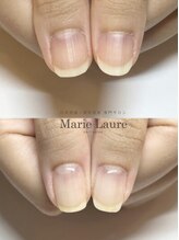 マリーロール 天王寺店(Marie Laure)/自爪育成/深爪矯正/ネイルケア