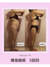 アコルデビューティー 恵比寿店(Acorde Beauty)/ビフォーアフター