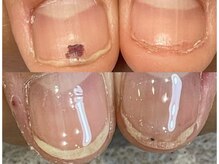 グレースレディ/深爪が恥ずかしかった