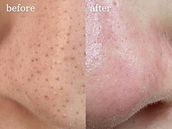 メルシア(merucia)/