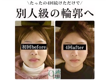 キュープ 福岡東店(Qpu)