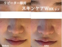 アールエーサロン 恵比寿 広尾(Ra salon)/スキンケアWAX
