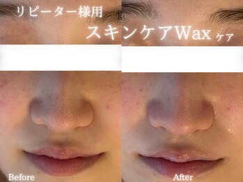アールエーサロン 恵比寿 広尾(Ra salon)/スキンケアWAX