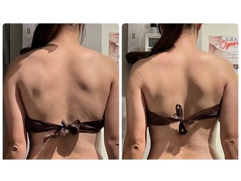 リラル 茅ヶ崎店(RERAR)/ブライダルケア1回