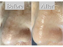 オレンジ(Orange)/