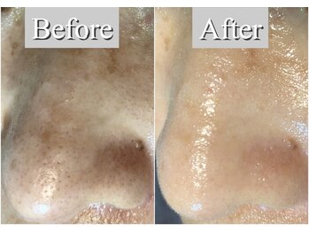 オレンジ(Orange)/