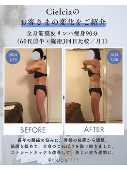 シェルシア(Cielcia)の写真/【圧倒的変化！軽さと見た目】筋膜×リンパで首肩改善×痩身を同時に叶えるオールハンド施術９０分¥8.500