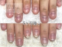 ココモ(cocomo)/(深爪/長さだし/フィルイン) 