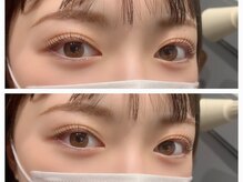 イヴ(Eve)/パリジェンヌラッシュリフト