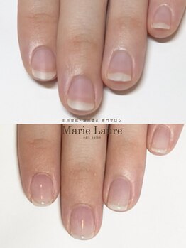 マリーロール 梅田店(Marie Laure)/自爪育成/深爪矯正/ネイルケア