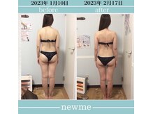 ニュウミー 諏訪本店(newme)/お客様ビフォーアフター
