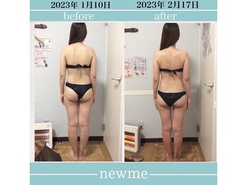 ニュウミー 諏訪本店(newme)/お客様ビフォーアフター