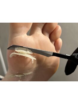 角質ケアができるサロン