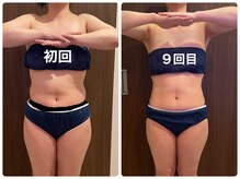 あきくに整骨院 美容整体院/来院頻度