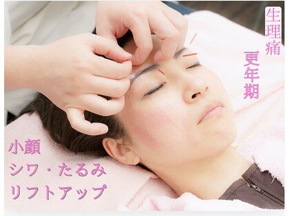 アキュピタル(acupital)の写真
