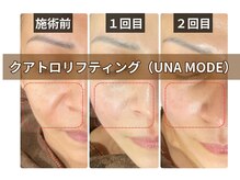 ウナトゥルービューティー(UNA true beauty)の雰囲気（日本初サロン導入店！ダウンタイムのいらない切らない３D小顔！）