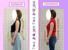 八女整体院/猫背/反り腰/ポッコリお腹改善♪