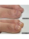 自爪育成ネイルケア