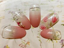 アペル(apare)/apare定額プラン　チューリップ