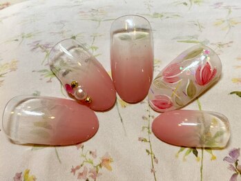 アペル(apare)/apare定額プラン チューリップ