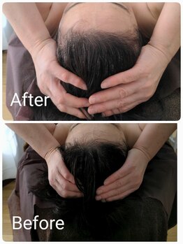 ラクシス(Luxis)/ヒマラヤンドライヘッド