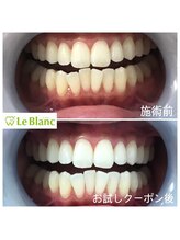 ルブラン 奈良店(Le Blanc)/お客様に合ったコースを！