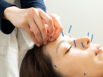 よみうりランド鍼灸整骨院/美容鍼/ツボを見極めて鍼を配置