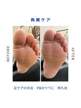 ピーアンドオー(P&O)/