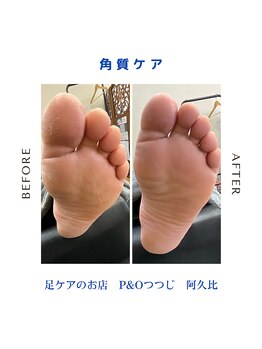 ピーアンドオー(P&O)/