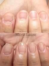 マリーロール 淀屋橋本店(Marie Laure)/自爪育成/深爪矯正/ネイルケア
