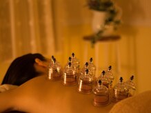 ティール(Teal)/首肩こりにはカッピング