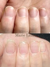 マリーロール 梅田店(Marie Laure)/深爪矯正/自爪育成/ネイルケア