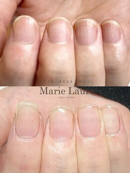 マリーロール 梅田店(Marie Laure)/深爪矯正/自爪育成/ネイルケア