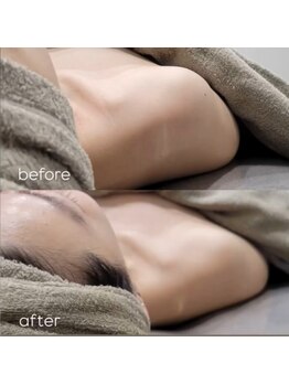 ネイルズビー 別邸(Nail's be)/asuka式筋膜リリース