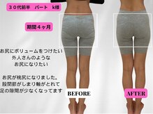 ビジリンヌ/ビフォーアフター４ヶ月