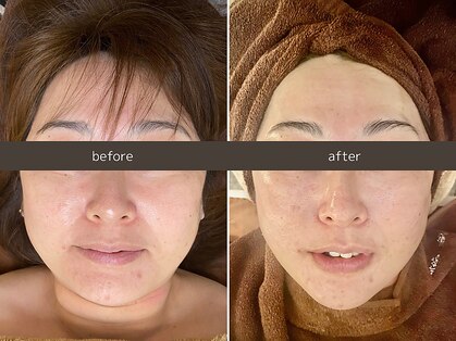 SEC(Shizuoka esthetic company)の写真