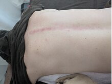 リデザイン 京都(REDESIGN)/REDESIGN京都中医施術法