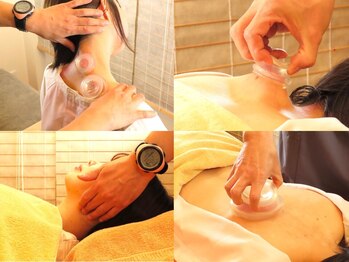 初田鍼院 恵比寿の写真/【デスクワークや立ち仕事でお疲れの方にオススメ！】首肩コリを根本から改善するので頭痛や眼精疲労にも◎