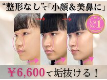 ラプリボヤージュ 藤沢店(Raplit)/ 隆鼻＋輪郭矯正30回