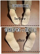 リバイブ 自由が丘店(REVIVE)/姿勢改善1回