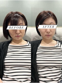 シロ(silo.)/ヒーリングケアクーポン